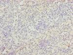ZBTB48 Polyclonal Antibody