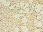 ZNF133 Antibody in Immunohistochemistry (Paraffin) (IHC (P))