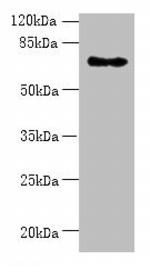 ZNF133 Antibody in Western Blot (WB)