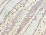 ZNF169 Antibody in Immunohistochemistry (Paraffin) (IHC (P))