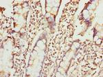 ZNF169 Polyclonal Antibody