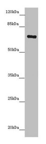 ZNF169 Antibody in Western Blot (WB)