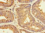 ZNF2 Antibody in Immunohistochemistry (Paraffin) (IHC (P))