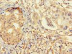 ZNF2 Antibody in Immunohistochemistry (Paraffin) (IHC (P))