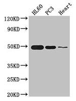 ZNF2 Antibody in Western Blot (WB)
