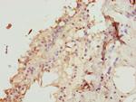 ZNF24 Antibody in Immunohistochemistry (Paraffin) (IHC (P))