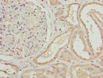 ZNF24 Antibody in Immunohistochemistry (Paraffin) (IHC (P))