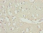 ZNF264 Antibody in Immunohistochemistry (Paraffin) (IHC (P))