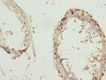 ZNF264 Polyclonal Antibody