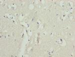 ZNF264 Antibody in Immunohistochemistry (Paraffin) (IHC (P))