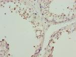 ZNF264 Polyclonal Antibody