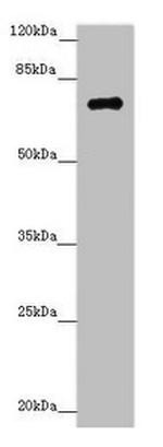 ZNF264 Antibody in Western Blot (WB)