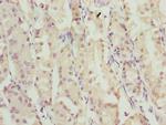 ZNF549 Polyclonal Antibody