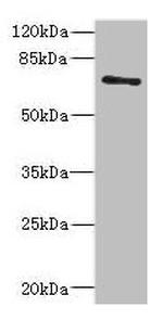 ZNF549 Antibody in Western Blot (WB)