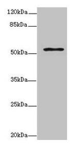 ZNF610 Antibody in Western Blot (WB)