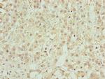 ZNF821 Polyclonal Antibody