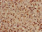 HSC70 Antibody in Immunohistochemistry (Paraffin) (IHC (P))