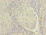 RAP1B Polyclonal Antibody