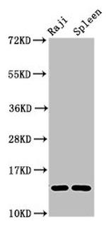 GABARAPL2 Antibody in Western Blot (WB)