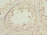 HSP40 Antibody in Immunohistochemistry (Paraffin) (IHC (P))