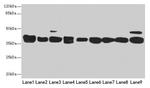 HSP40 Antibody in Western Blot (WB)