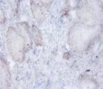 AFG3L2 Polyclonal Antibody