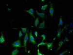 KARS Polyclonal Antibody