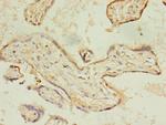 ACSL4 Polyclonal Antibody