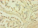 Cytochrome P450 Reductase Polyclonal Antibody
