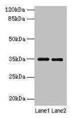 Thrombopoietin Polyclonal Antibody