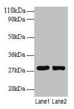MPZ Polyclonal Antibody