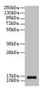 BNP Polyclonal Antibody