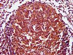 CD27 Antibody in Immunohistochemistry (Paraffin) (IHC (P))