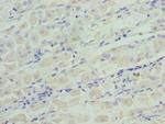 IGFBP-1 Polyclonal Antibody