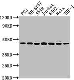 CSNK2A3 Antibody in Western Blot (WB)