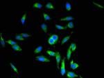 Periostin Polyclonal Antibody