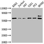 CD73 Antibody in Western Blot (WB)