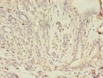 gamma Catenin Polyclonal Antibody