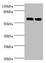 TROVE2 Antibody in Western Blot (WB)