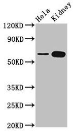 TROVE2 Antibody in Western Blot (WB)