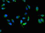 HLA-ABC Antibody in Immunocytochemistry (ICC/IF)