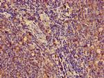 HLA-ABC Antibody in Immunohistochemistry (Paraffin) (IHC (P))