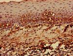 HLA-ABC Antibody in Immunohistochemistry (Paraffin) (IHC (P))