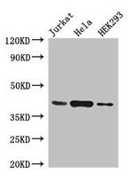 HLA-ABC Antibody in Western Blot (WB)
