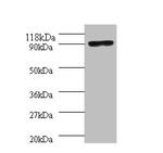 POLA1 Polyclonal Antibody