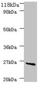 deoD Polyclonal Antibody