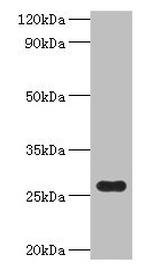 FRE Antibody in Western Blot (WB)