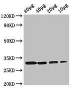 RBKS Polyclonal Antibody