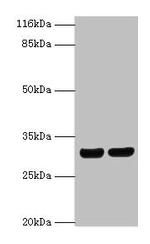 HLA-DRB1 Antibody in Western Blot (WB)