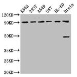 OCA2 Polyclonal Antibody
